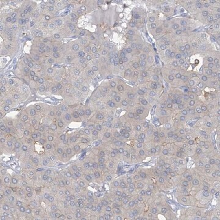 Anti-TRMT2B antibody produced in rabbit, 1 X 100 µL (HPA035120-100UL)