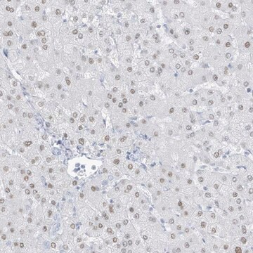 Anti-ZFP64 antibody produced in rabbit, 1 X 100 µL (HPA035112-100UL)