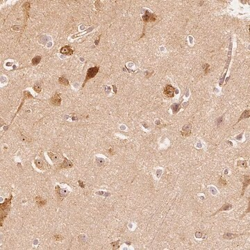 Anti-ARHGAP26 antibody produced in rabbit, 100 µL (HPA035106-100UL)