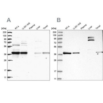 Anti-TBCC antibody produced in rabbit, 100 µL (HPA035074-100UL)