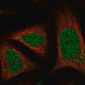 Anti-RNASEH1 antibody produced in rabbit, 1 X 100 µL (HPA034817-100UL)