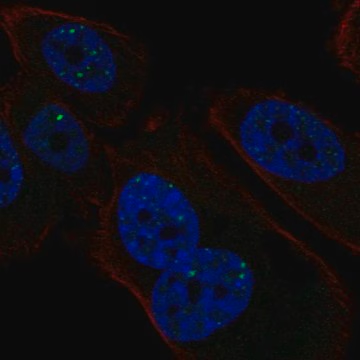 Anti-PMS1 antibody produced in rabbit, 100 µL (HPA031013-100UL)
