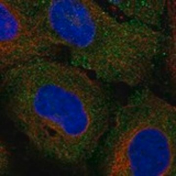 Anti-GJB7 antibody produced in rabbit, 1 X 100 µL (HPA014392-100UL)