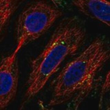 Anti-DNAJC5 antibody produced in rabbit, 1 X 100 µL (HPA012139-100UL)