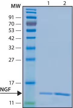 Nerve Growth Factor-ß human, 100 µG (N5415-100UG)