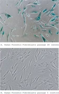 Senescence Cells Histochemical Staining Kit, 1 X 1 kit (CS0030-1KT)