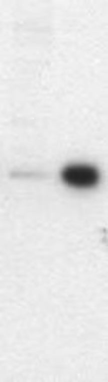 PhosphoDetect Anti-VASP (pSer¹⁵⁷) Mouse mAb (5C6), 100 µG (676604-100UG)