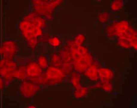 Anti-EGFR (Ab-5) Mouse mAb (EGFR.1), 100 µG (GR15L-100UG)