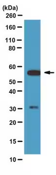Anti-Calcineurin pan A Antibody, 1 ea (71491-3)