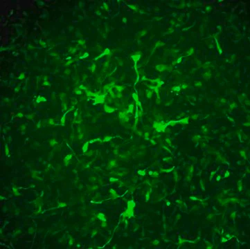 Alzheimer’s In A Dish™ APPSL-GFP Lentivirus, 15 μL (SCR526)