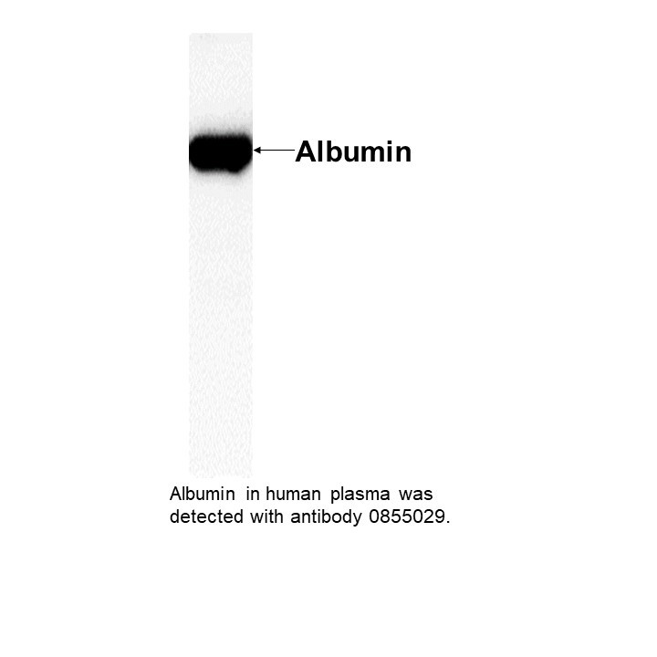 IgG Rabbit Anti-Human Albumin, 2 ML