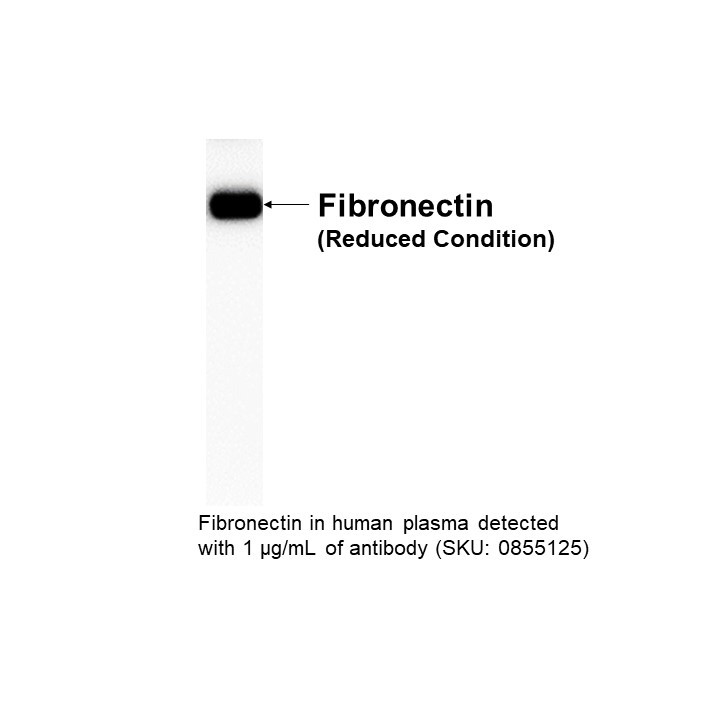 Anti-human fiberonectin, goat antiserum, 60.2mg/ml, 2 ML