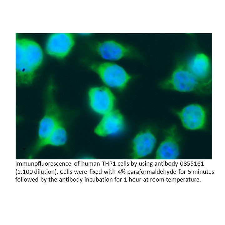 Anti-human lambda Light chain (Free Bence-Jones Protein) goa, 2 ML