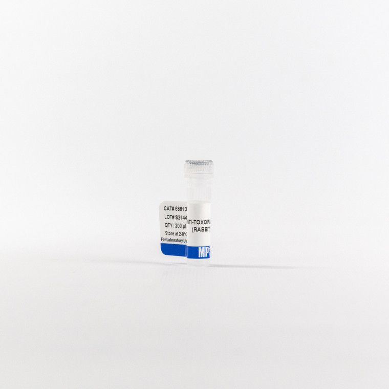 Anti-toxoplasma Gondii rabbit antibody, 200 UL