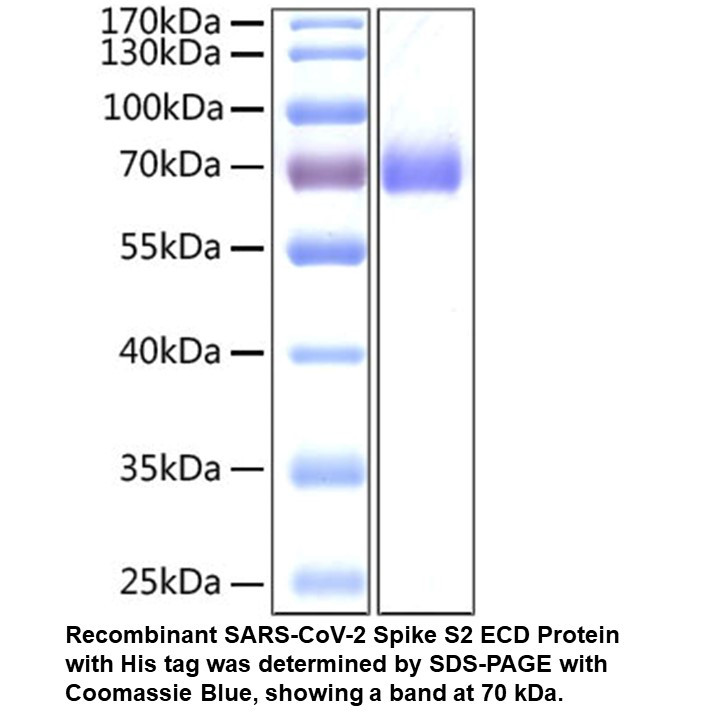 Recombinant SARS-CoV-2 Spike S 2 ECD Protein (His tag), 100 UG