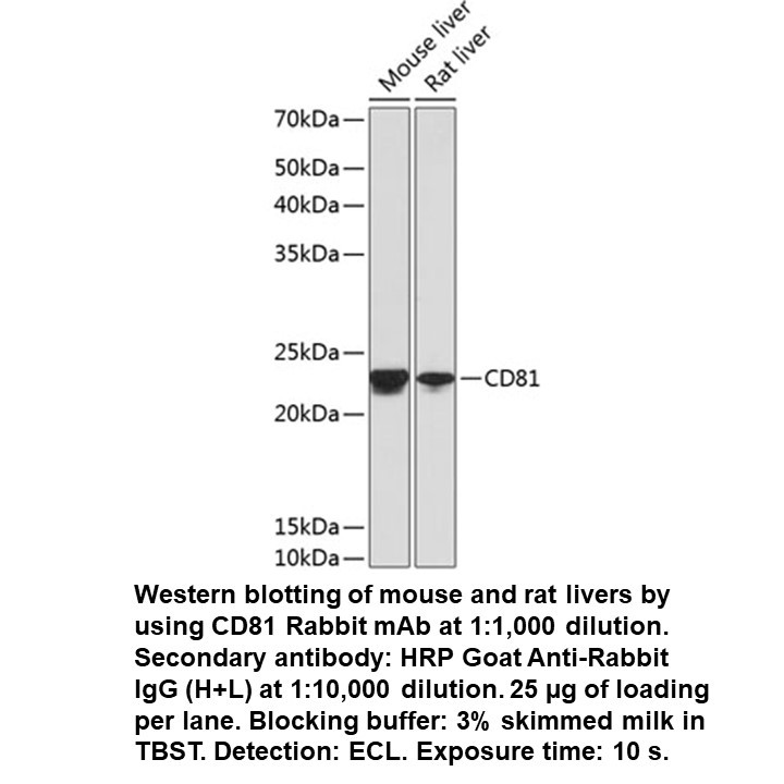 CD81 Rabbit Monoclonal Antibody, 100 UL