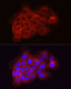 Coagulation factor III/Tissue Factor Rabbit pAb, Polyclonal (A1378) | ABclonal Technology™
