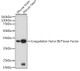 Coagulation factor III/Tissue Factor Rabbit pAb, Polyclonal (A1378) | ABclonal Technology™