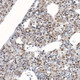 Survivin Rabbit pAb, Polyclonal (A1551) | ABclonal Technology™