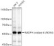 Western blot analysis of various lysates, using NADPH oxidase 4 (NOX4) Rabbit mAb (A22149) at  1:1000 dilution.<br/>Secondary antibody: HRP-conjugated Goat anti-Rabbit IgG (H+L) (AS014) at 1:10000 dilution.<br/>Lysates/proteins: 25μg per lane.<br/>Blocking buffer: 3% nonfat dry milk in TBST.<br/>Detection: ECL Basic Kit (RM00020).<br/>Exposure time: 90s.|Confocal imaging of HeLa cells using NADPH oxidase 4 (NOX4) Rabbit mAb (A22149, dilution 1:100) (Red). DAPI was used for nuclear staining (blue). Objective: 60x.