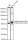 Western blot analysis of various lysates using Glutaminase (GLS) Rabbit mAb (A23189) at 1:1000 dilution incubated at room temperature for 1.5 hours.<br/>Secondary antibody: HRP-conjugated Goat anti-Rabbit IgG (H+L) (AS014) at 1:10000 dilution.<br/>Lysates/proteins: 25 μg per lane.<br/>Blocking buffer: 3% nonfat dry milk in TBST.<br/>Detection: ECL Basic Kit (RM00020).<br/>Negative control (NC): Mouse liver.<br/>Exposure time: 1s.|Western blot analysis of lysates from Rat kidney using Glutaminase (GLS) Rabbit mAb (A23189) at 1:1000 dilution incubated at room temperature for 1.5 hours.<br/>Secondary antibody: HRP-conjugated Goat anti-Rabbit IgG (H+L) (AS014) at 1:10000 dilution.<br/>Lysates/proteins: 25 μg per lane.<br/>Blocking buffer: 3% nonfat dry milk in TBST.<br/>Detection: ECL Basic Kit (RM00020).<br/>Exposure time: 1s.|Confocal imaging of U-2 OS cells using Glutaminase (GLS) Rabbit mAb (A23189, dilution 1:200) followed by a further incubation with Cy3 Goat Anti-Rabbit IgG (H+L) (AS007, dilution 1:500) (Red). The cells were counterstained with α-Tubulin Mouse mAb (AC012, dilution 1:400) followed by incubation with ABflo® 488-conjugated Goat Anti-Mouse IgG (H+L) Ab (AS076, dilution 1:500) (Green). DAPI was used for nuclear staining (Blue). Objective: 100x.|Confocal imaging of NIH/3T3 cells using Glutaminase (GLS) Rabbit mAb (A23189, dilution 1:200) followed by a further incubation with Cy3 Goat Anti-Rabbit IgG (H+L) (AS007, dilution 1:500) (Red). The cells were counterstained with α-Tubulin Mouse mAb (AC012, dilution 1:400) followed by incubation with ABflo® 488-conjugated Goat Anti-Mouse IgG (H+L) Ab (AS076, dilution 1:500) (Green). DAPI was used for nuclear staining (Blue). Objective: 100x.|Confocal imaging of PC-12 cells using Glutaminase (GLS) Rabbit mAb (A23189, dilution 1:200) followed by a further incubation with Cy3 Goat Anti-Rabbit IgG (H+L) (AS007, dilution 1:500) (Red). The cells were counterstained with α-Tubulin Mouse mAb (AC012, dilution 1:400) followed by incubation with ABflo® 488-conjugated Goat Anti-Mouse IgG (H+L) Ab (AS076, dilution 1:500) (Green). DAPI was used for nuclear staining (Blue). Objective: 100x.