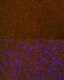 Coagulation Protein C Rabbit mAb, Monoclonal (A4532) | ABclonal Technology™