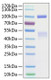 Recombinant Human HGF receptor/c-MET/MET Protein was determined by SDS-PAGE under reducing conditions with Coomassie Blue.|Immobilized recombinant human HGFR at 2 μg/mL (100 μL/well) can bind Rrecombinant human HGF with a linear range of 25-250 ng/mL.