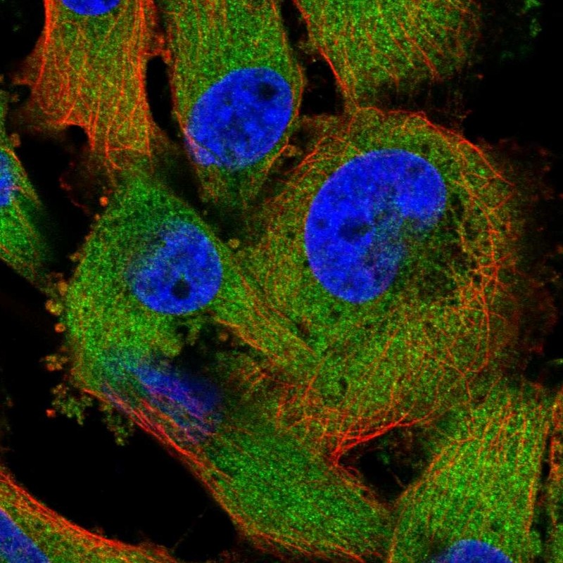 Anti-ZC3HAV1 Antibody, Polyclonal (HPA059096)