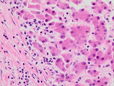 Phosphorus tribromide, 1 X 5 g (256536-5G) | MilliporeSigma