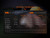 Fenix CL28R Rechargeable Lantern with Color Adjustment, 2000 Lumens   Fenix CL28R Rechargeable Lantern with Color Adjustment, 2000 Lumens