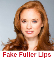 fuller-lips2.jpg