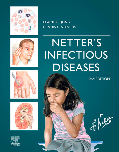 (eBook PDF) Netter's Infectious Diseases
2nd Edition (eBook PDF) Netter's Infectious Diseases
2nd Edition