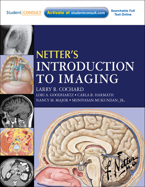 (eBook PDF) Netter's Introduction to Imaging (eBook PDF) Netter's Introduction to Imaging