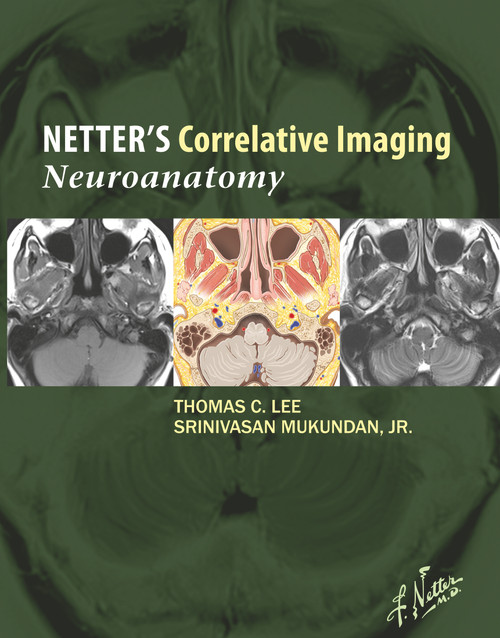 (eBook PDF) Netters Correlative Imaging: Neuroanatomy with NetterReference.com Access (eBook PDF) Netters Correlative Imaging: Neuroanatomy with NetterReference.com Access