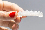 How much do pop-on veneers cost?