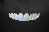 How Much Do Porcelain Dental Veneers Cost? - us.instasmile.com
