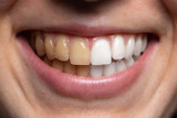 New Year, New Teeth