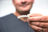 Are there non-surgical dental implants?