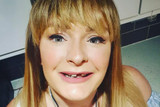 Dental Bridge for Elderly Missing Teeth