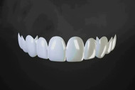 Can You Get Veneers After Invisalign? - us.instasmile.com