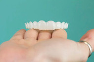 How Much Do Clip-on Veneers Cost