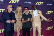 What did Simon Cowell do to his teeth?