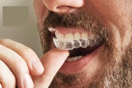 What Is Invisalign?