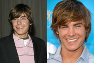 What did Zac Efron do to his teeth?