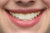 instasmile ReOrder