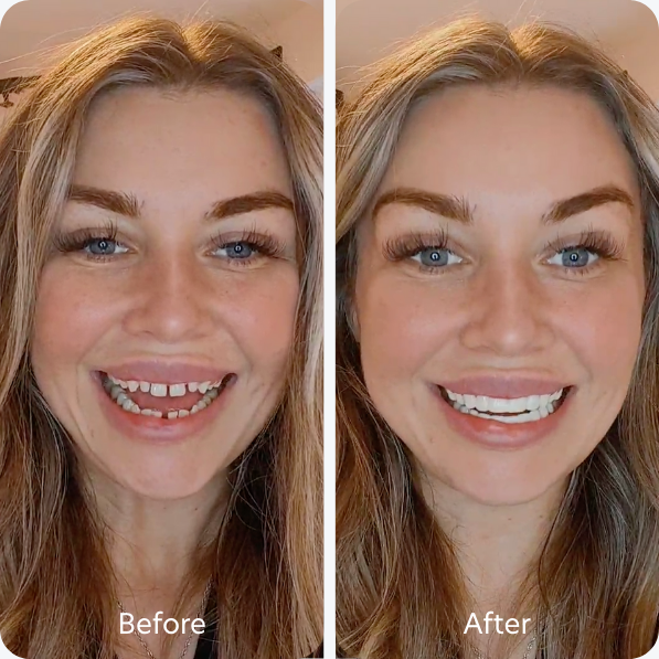 Gaps Between Teeth teeth