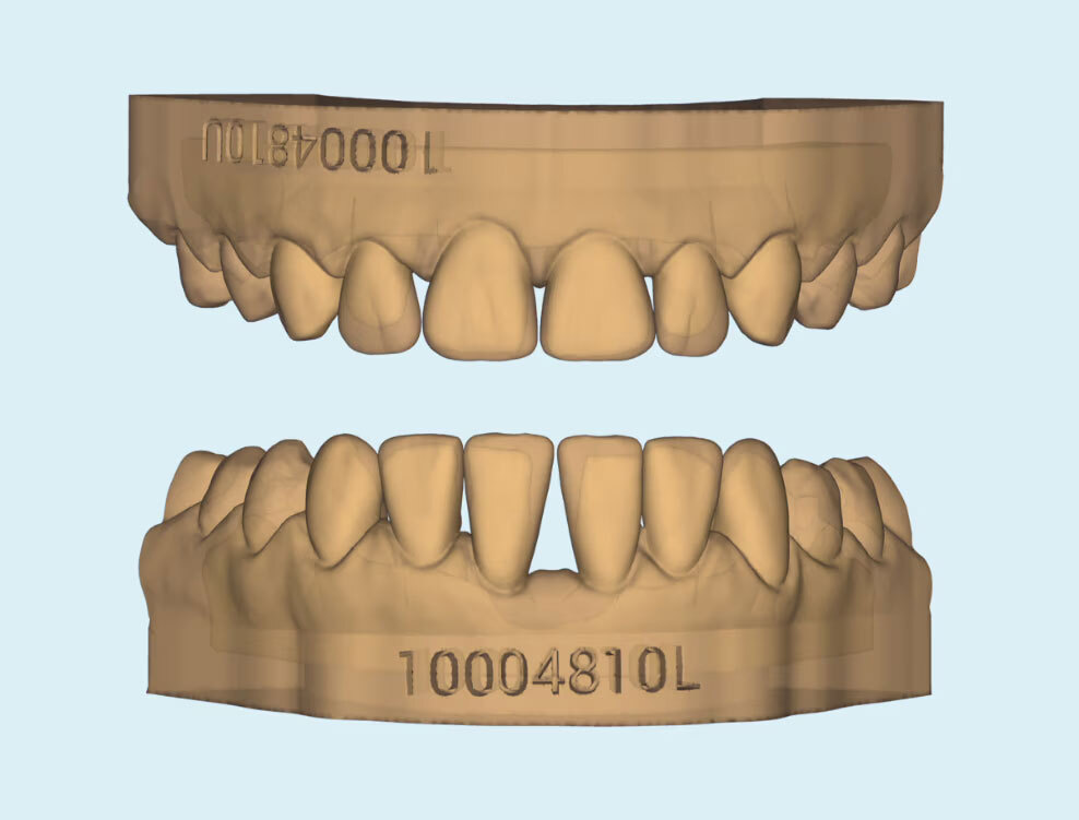 3D CAD design