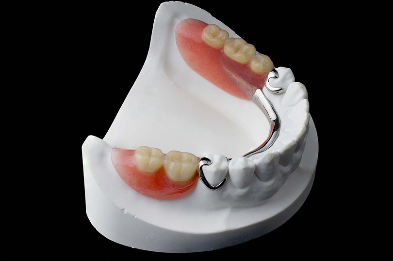 Comparison of permanent and temporary dentures