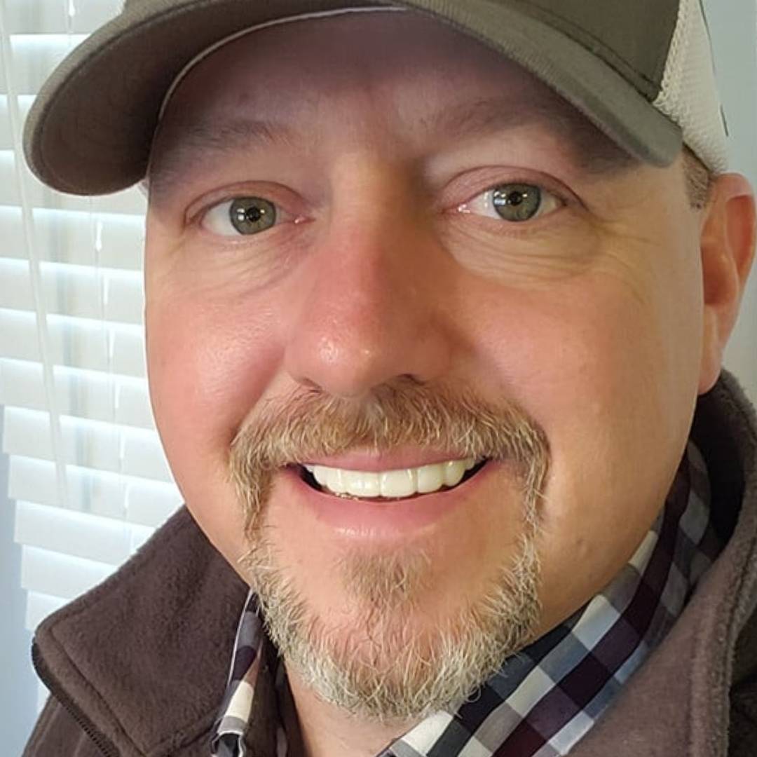 Alternatives to Invisalign - instasmile