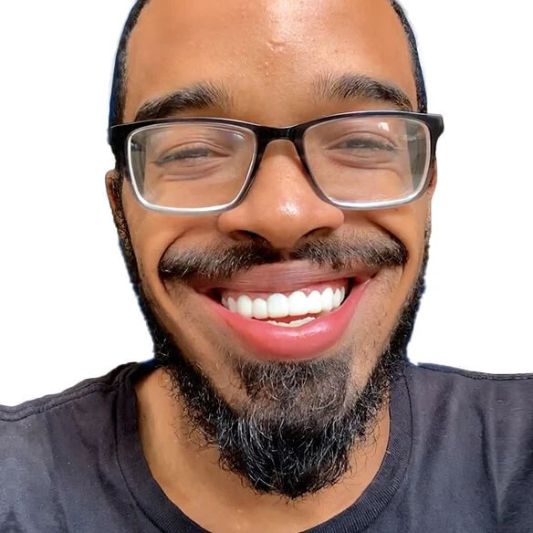 Fake teeth that go over real teeth